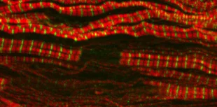 Myopathy research image